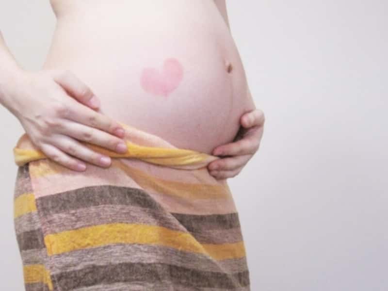 妊娠線予防は妊娠3ヶ月ぐらいから開始が目安 早めに始めるとなお良し ママびよりウェブ