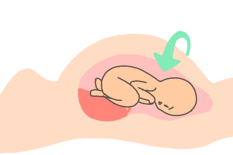 イラスト マンガ付で解説 出産の流れ 経膣分娩の進み方 ママびよりウェブ