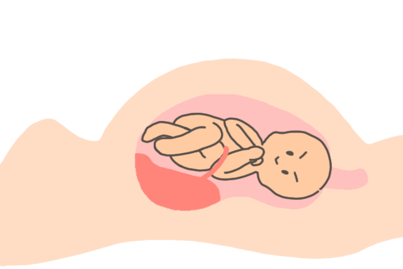 イラスト マンガ付で解説 出産の流れ 経膣分娩の進み方 ママびよりウェブ