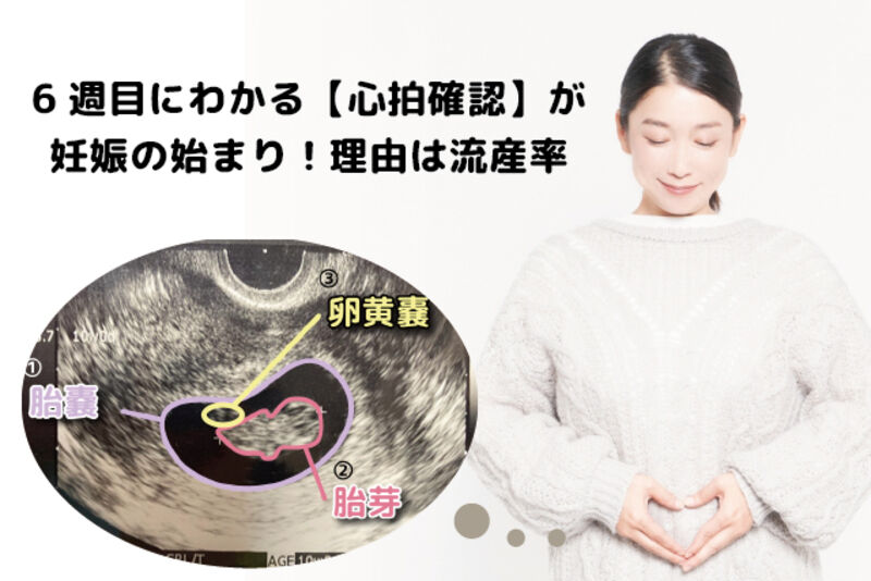 6週目にわかる 心拍確認 が 妊娠の始まり 理由は流産率 ママびよりウェブ